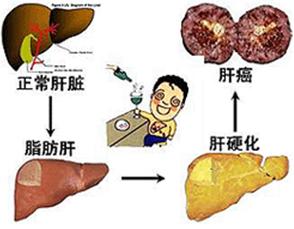 肝脏病变过程